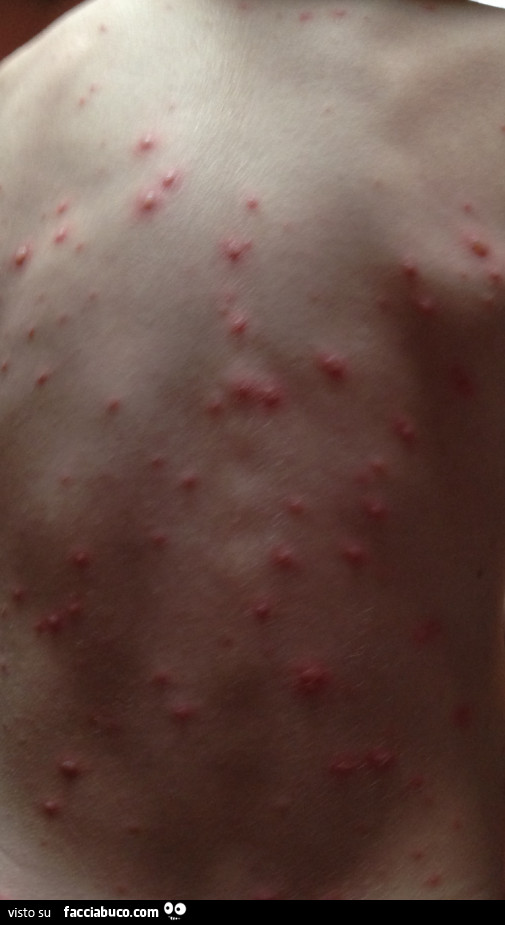 Vaccata